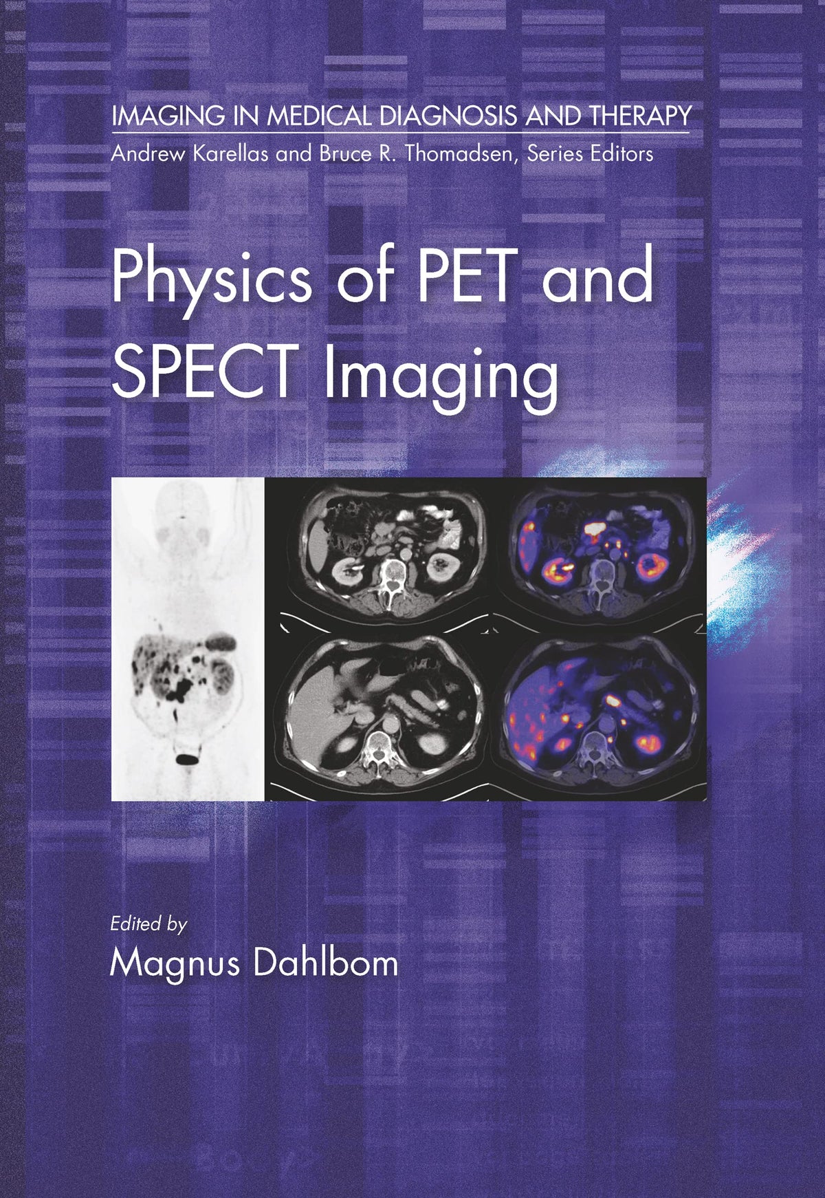 Physics of PET and SPECT Imaging in Medical Diagnosis and Therapy): 1st Edition