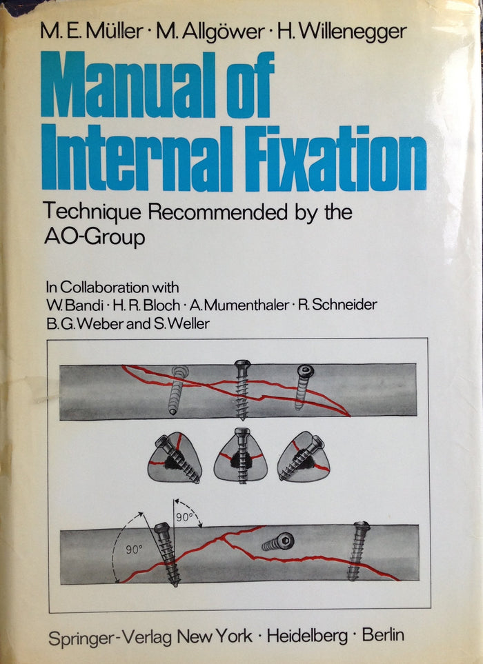 Manual of internal fixation;: Technique recommended by the AO-Group