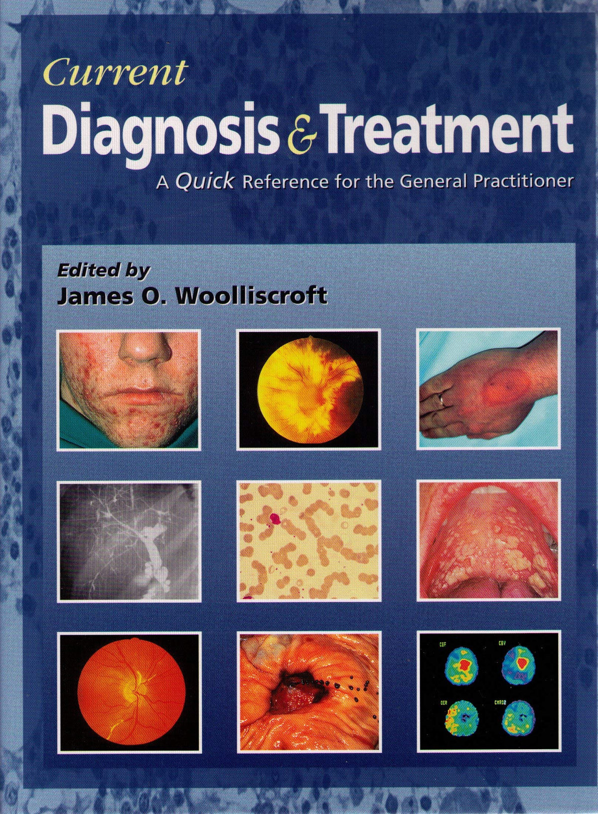 Current Diagnosis & Treatment: A Quick Reference for the General Practitioner